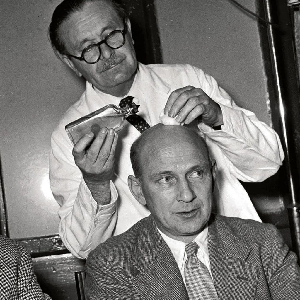 History of Hair Transplantation